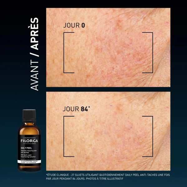 filorga-daily-peel-antimanchas-50ml-peeling-noturno-corrige-manchas-e-uniformiza-o-tom-1.webp